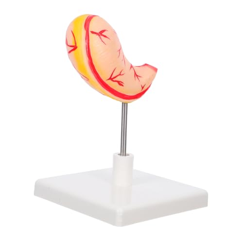 MAGICLULU Anatomisches Magenmodell Lehrmittel Realistische Stomach Learning Model Abnehmbar für Medizinische Ausbildung Wissenschaftliche und Klinische Trainings von MAGICLULU
