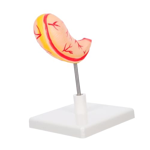 MAGICLULU Anatomisches Magenmodell Stabile Ausführung Realistische Darstellung Medizinisches Lehrmodell Für Klinische Schulungen Und Wissenschaftliche Ausbildung von MAGICLULU