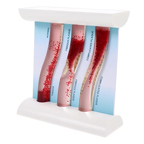 MAGICLULU Dynamisches Blutgefäßmodell Anatomisches Modell zur Veranschaulichung von Blutgefäßen Cholesterinschäden für Medizinische Fachkräfte Lehrzwecke MAGICLULU Dynamisches Blutgefäßmodell Anatomisches Modell zur Veranschaulichung von Blutgefäßen Cholesterinschäden für Medizinische Fachkräfte Lehrzwecke von MAGICLULU