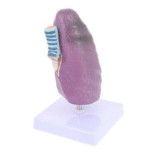 MAGICLULU Lungenmodellunterrichtshilfen Anatomiemodell Pathologisches Lungenmodell Modell Anatomie Anatomisches Modell der Lunge Lungenmodell für die Ausbildung Plastik MAGICLULU Lungenmodellunterrichtshilfen Anatomiemodell Pathologisches Lungenmodell Modell Anatomie Anatomisches Modell der Lunge Lungenmodell für die Ausbildung Plastik von MAGICLULU