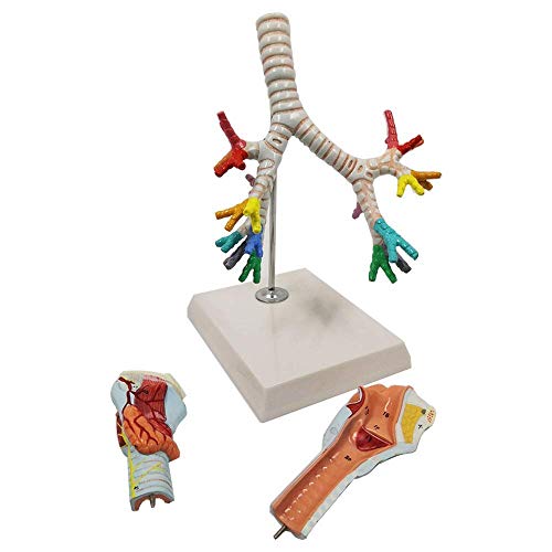MOLVUS Anatomie-Modell, Körper, Bronchialbaum, Lungenanatomie, menschliches Atmungssystem, Modell für medizinische Anatomie und Wissenschaft, Display, Lehren, medizinisch, exquisit von MOLVUS