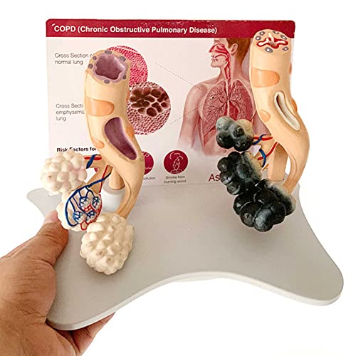 MOLVUS Lungenmodell Menschliche Lunge und Atemwege Modell Lungenluftröhre Anatomie Modell Lungenanatomie Trachealstruktur Lungenmodell für Büro Pädagogisches Werkzeug von MOLVUS