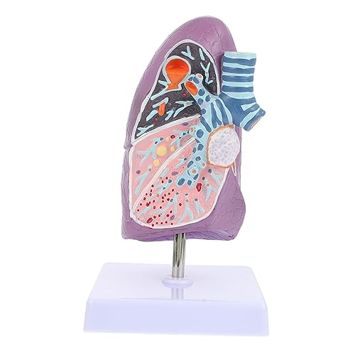 MUCKLILY Lungenanatomiemodell Atemwegslungenmodell Nützliches Modell Pathologisches Modell Anatomisches Modell Pathologisches Lungenmodell Lungenmodell Zum Unterrichten Des Rauchens von MUCKLILY
