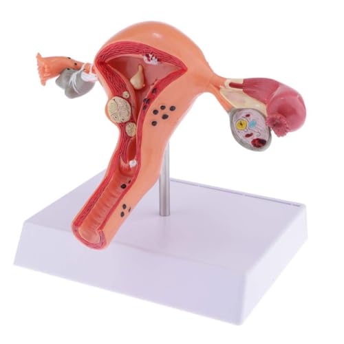 Weibliche menschliche Uterus-Struktur Kunststoff Modell Studenten pädagogisches Display Experiment Zubehör für Labor Weibliche menschliche Uterus-Struktur Kunststoff Modell Studenten pädagogisches Display Experiment Zubehör für Labor von Mealoodiousmusea
