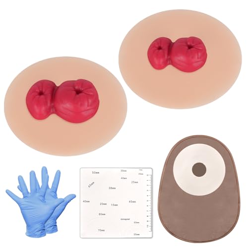 MedEduQuest Sticky Loop Ileostomie-Simulatoren, Stoma-Trainingsmodell-Set, Praxismodelle für die Stomapflege in mehreren Hauttönen für die medizinische Ausbildung und Patientenaufklärung – Leicht von MedEduQuest