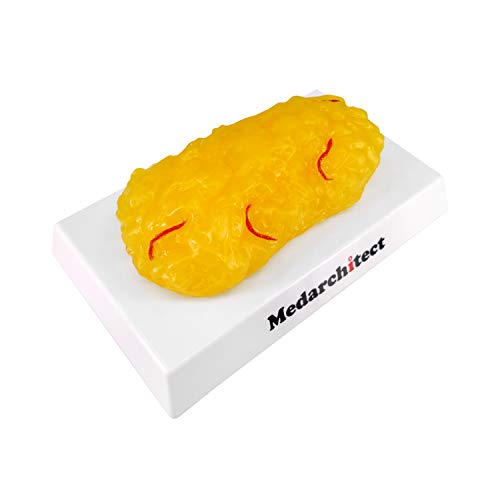 Authentische Nachbildung des menschlichen Körperfetts mit roten Adern - 1 lb, Fit & Gewichtsverlust Motivation & Erinnerung für Ernährungswissenschaftler, Wissenschaftskurs Authentische Nachbildung des menschlichen Körperfetts mit roten Adern - 1 lb, Fit & Gewichtsverlust Motivation & Erinnerung für Ernährungswissenschaftler, Wissenschaftskurs von Medarchitect
