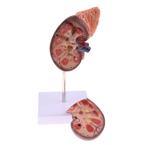 NSXAYIWE Nierenmodell, Anatomisches Modell der menschlichen Niere mit Sockel, in 2 Teile unterteilt, die die innere Struktur Zeigen. Eine Normale Nachbildung der menschlichen NSXAYIWE Nierenmodell, Anatomisches Modell der menschlichen Niere mit Sockel, in 2 Teile unterteilt, die die innere Struktur Zeigen. Eine Normale Nachbildung der menschlichen von NSXAYIWE