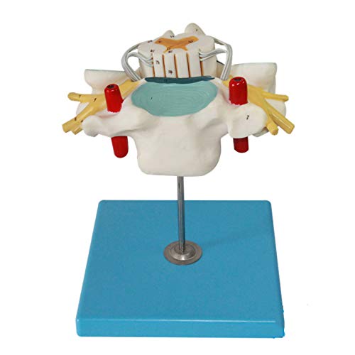 OLSDXAWQ, Menschliche Halswirbelsäule mit Rückenmarks- und Spinalnervenvergrößerungsmodell, neuroorthopädisches anatomisches Modell, es gibt 21 Positionsindikatoren for den medizinischen Unterricht von OLSDXAWQ