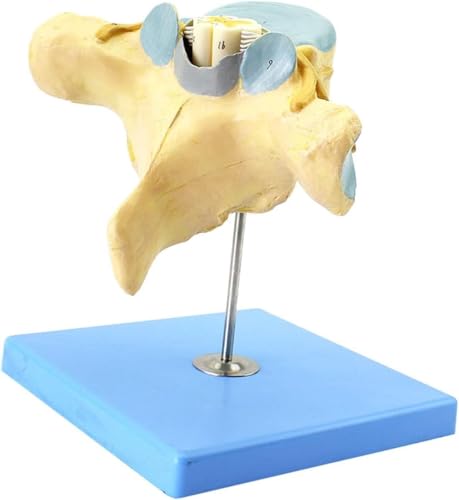 OLSDXAWQ, Vergrößertes Modell menschlicher Halswirbel mit Rückenmark und Spinalnerven. Neuro-Orthopädie, anatomisches Modell, Neuro-Orthopädie-Lehre OLSDXAWQ, Vergrößertes Modell menschlicher Halswirbel mit Rückenmark und Spinalnerven. Neuro-Orthopädie, anatomisches Modell, Neuro-Orthopädie-Lehre von OLSDXAWQ