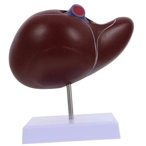 OSOLADY Leberanatomisches Modell für Medizinische Lehre Realistisches Menschliches Lebermodell mit Basis für Schule Universität Pflegeeinrichtungen OSOLADY Leberanatomisches Modell für Medizinische Lehre Realistisches Menschliches Lebermodell mit Basis für Schule Universität Pflegeeinrichtungen von OSOLADY