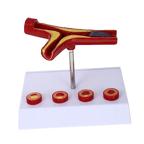 PLAFOPE Showmodell Menschliches Herz-kreislauf-modell Pvc-material Pädagogisches Lehrmittel Realistische Darstellung Der Plaque-pathologie PLAFOPE Showmodell Menschliches Herz-kreislauf-modell Pvc-material Pädagogisches Lehrmittel Realistische Darstellung Der Plaque-pathologie von PLAFOPE
