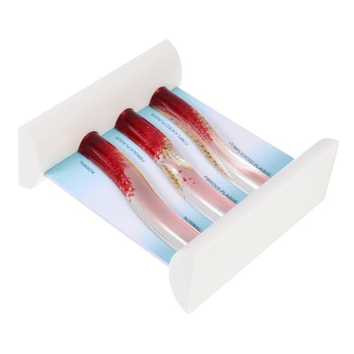 PRETYZOOM Anatomisches Modell Blutgefäßmodell Für Medizinische Schulungen Dynamisches Blutlipid Modell Zur Veranschaulichung Von Vaskulären Prozessen Teiliges von PRETYZOOM