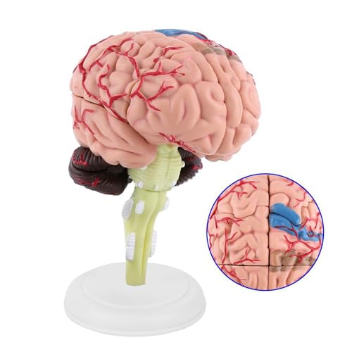 Anatomisches Modell des Menschlichen Gehirns – Kunststoff, Farbenfrohe Bemalung, Trainingsgerät und Spielzeug für das Studium der Gehirnanatomie Anatomisches Modell des Menschlichen Gehirns – Kunststoff, Farbenfrohe Bemalung, Trainingsgerät und Spielzeug für das Studium der Gehirnanatomie von Qcwwy
