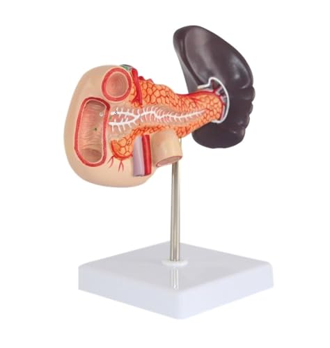 Anatomie Modell Menschliches Milz- Und Bauchspeicheldrüsenmodell, Anatomisches Menschliches Bauchspeicheldrüsen-Zwölffingerdarm-Milzmodell Als Studienanzeigewerkzeug Anatomie Eines Falls Anatomie Modell Menschliches Milz- Und Bauchspeicheldrüsenmodell, Anatomisches Menschliches Bauchspeicheldrüsen-Zwölffingerdarm-Milzmodell Als Studienanzeigewerkzeug Anatomie Eines Falls von REIFOR