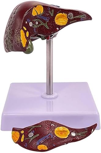 Anatomisches Modell der menschlichen Leber, Leberzirrhose-Modell, pathologisches Leberanatomiemodell in Lebensgröße, klare Textur und pathologische Merkmale, for das Studium und die Forschung an mediz von RMJEZTQD