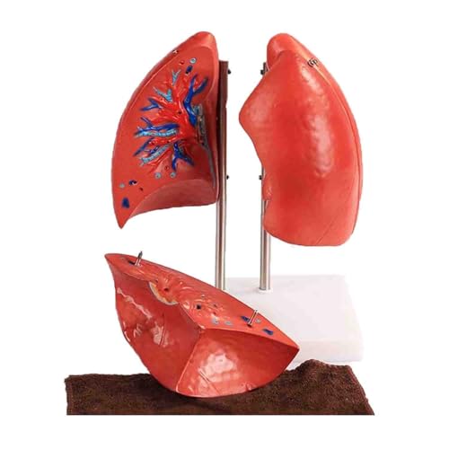 Modell einer menschlichen Lunge, Modell einer gesunden Lunge, abnehmbares anatomisches Modell einer menschlichen Lunge mit 4 abnehmbaren Teilen, Lehrmittel for Lungenmodelle, for Arztpraxen und Klasse Modell einer menschlichen Lunge, Modell einer gesunden Lunge, abnehmbares anatomisches Modell einer menschlichen Lunge mit 4 abnehmbaren Teilen, Lehrmittel for Lungenmodelle, for Arztpraxen und Klasse von RMJEZTQD