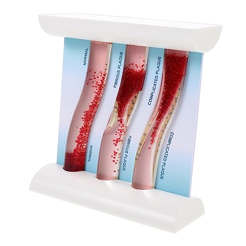 ROMISBABA Gefäßmodell Kunststoff Blutgefäßmodell Lehrmodell Lehrmodell Dynamisches Modell Anatomisches Modell Dynamisches Blutgefäßmodell Acryl ROMISBABA Gefäßmodell Kunststoff Blutgefäßmodell Lehrmodell Lehrmodell Dynamisches Modell Anatomisches Modell Dynamisches Blutgefäßmodell Acryl von ROMISBABA