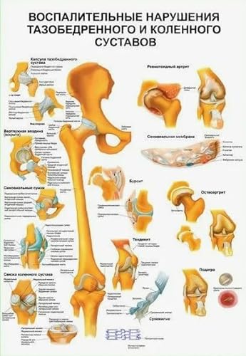 RUIYANMQ Holzpuzzle 1000 Teile Muskelsystem Anatomisches Poster Für Erwachsene Kinder Lernspielzeug Dekompressionsspiel Ju757Xa von RUIYANMQ