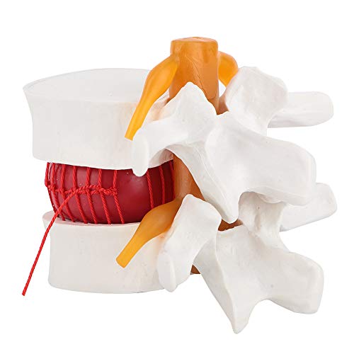 Anatomie Menschen Lendenwirbelsäule, 1: 1,5 Demonstrationsmodell Menschlichen Lendenwirbelsäulen Modells Medizinischen Demonstration Anatomie Menschen Lendenwirbelsäule, 1: 1,5 Demonstrationsmodell Menschlichen Lendenwirbelsäulen Modells Medizinischen Demonstration von Walfront