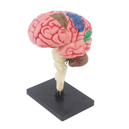 4D Gehirnnachbildung - Modell der menschlichen Anatomie - Hier ein Produkttitel für eine Angebotsstruktur - Detaillierte Lehrhilfe im Klassenzimmer - chirurgisches Schulungsset von SHINROAD