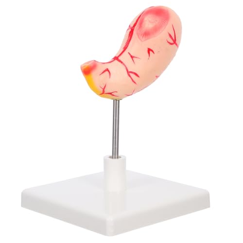 SOLUSTRE Anatomisches Magenmodell Stomach Dissection Model aus Robustem Material Realistische Darstellung für Studenten und Medizinische Ausbildung Leicht Montierbar von SOLUSTRE