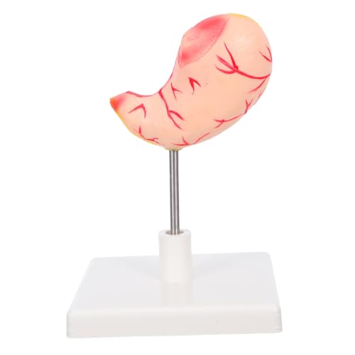 SOLUSTRE Anatomisches Magenmodell mit Präziser Detailstruktur Realistisches Menschliches Organ für Medizinische Ausbildung Leicht Montierbar Geeignet für Studenten Forschung und Klinische von SOLUSTRE