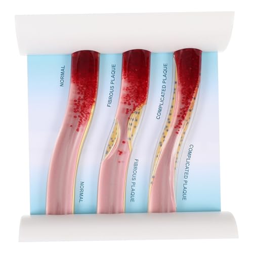 SOLUSTRE Gefäßmodell Unterrichtsmodell Plastisches Anatomisches Modell Dynamisches Anatomisches Modell Dynamisches Modell Unterrichten Lehrmodell Aus Kunststoff Acryl von SOLUSTRE