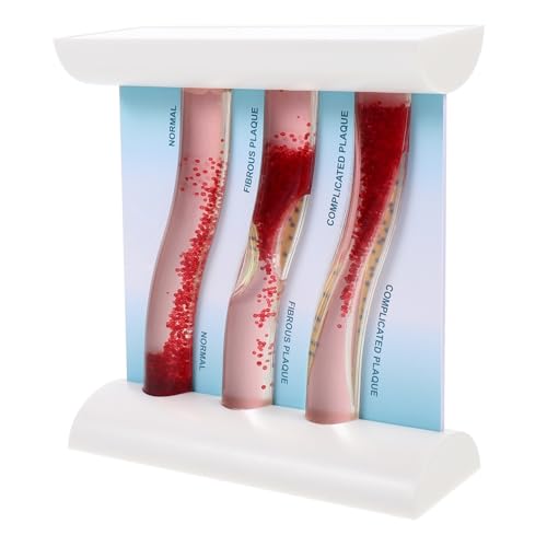 STOBAZA Dynamisches Blutgefäßmodell aus Anatomisches Lehrmodell mit Normaler und Plaque Gefährdeter Arterie Realistisches Medizinmodell für Schulungen und Studium von STOBAZA