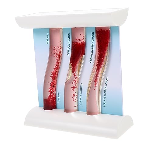 Sosoport Anatomisches Blutgefäßmodell aus Hochsimuliertes Gefäßmodell zur Darstellung von Gesunden und Erkrankten Blutgefäßen für Medizinische Lehrzwecke Sosoport Anatomisches Blutgefäßmodell aus Hochsimuliertes Gefäßmodell zur Darstellung von Gesunden und Erkrankten Blutgefäßen für Medizinische Lehrzwecke von Sosoport