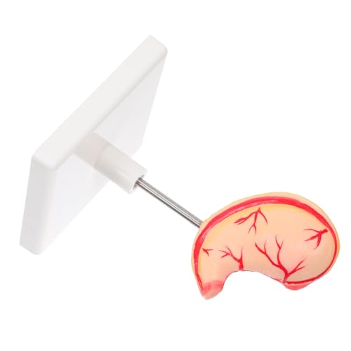 TINEASUR Anatomisches Magenmodell Realistische Präzise Details Robustes Material Lehrmodell für Medizinische Ausbildung und Klinische Lehre TINEASUR Anatomisches Magenmodell Realistische Präzise Details Robustes Material Lehrmodell für Medizinische Ausbildung und Klinische Lehre von TINEASUR