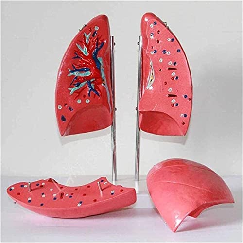 TONZN Anatomiemodell der menschlichen Lunge Menschliches Organ Lunge Demonstrationsmodell Abnehmbares 4-teiliges Anatomiemodell für die Pathologieforschung für Erwachsene von TONZN