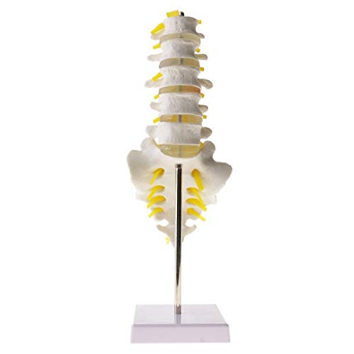 TONZN Lehrmodell Menschliches Wirbelsäulenmodell Anatomiemodell Lendenwirbelsäule/Kreuzbein und Steißbein mit Bandscheibenvorfall Medizinische Anatomie Menschliches Skelettmodell von TONZN