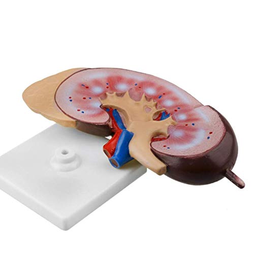 TONZN Menschliches Nierenmodell, Anatomie, Bildungsmodell, Schulunterricht, Display, Laborbedarf und Unterrichtsmaterialien von TONZN