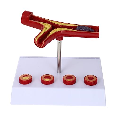 TOPPERFUN Anatomisches Modell Des Menschlichen Herz Kreislauf Systems Zur Darstellung Von Atherosklerose Lehrmodell Für Medizinische Ausbildung Demonstration Realistische Details von TOPPERFUN