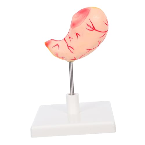 TOPPERFUN Magenmodell Detailliertes Magenanatomiemodell Für Studenten Und Fachleute – 3D Magenstruktur Zum Lernen Von Und Physiologie TOPPERFUN Magenmodell Detailliertes Magenanatomiemodell Für Studenten Und Fachleute – 3D Magenstruktur Zum Lernen Von Und Physiologie von TOPPERFUN