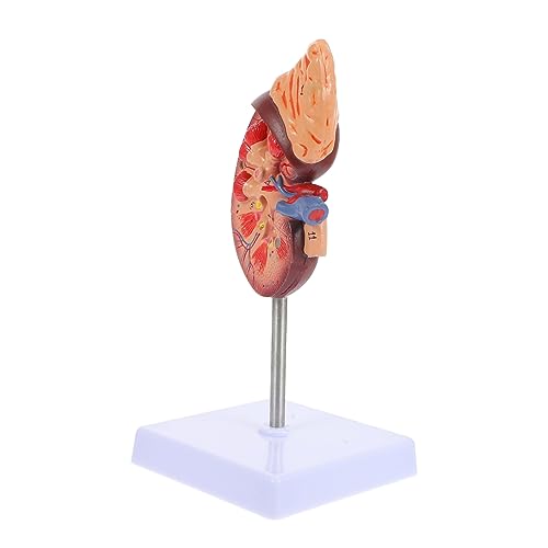 Toyvian Anatomisches Modell Der Menschlichen Niere Basishalterung Schulbildungsstütze Für Das Lernen Von Jungen Und Mädchen Toyvian Anatomisches Modell Der Menschlichen Niere Basishalterung Schulbildungsstütze Für Das Lernen Von Jungen Und Mädchen von Toyvian