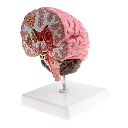 Tubayia Verkleinerung 1X Menschliches Gehirn Modell Pathologisches Anatomie Modell Lernmodell Laborbedarf Tubayia Verkleinerung 1X Menschliches Gehirn Modell Pathologisches Anatomie Modell Lernmodell Laborbedarf von Tubayia