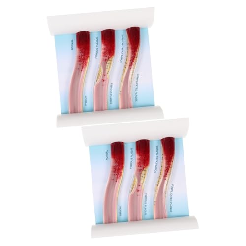 ULTECHNOVO 2st Gefäßmodell Unterrichtsmodell Anatomiemodell Der Blutgefäße Dynamisches Anatomisches Modell Männchen Körper Schaufensterpuppe Modell Menschlicher Blutgefäße Acryl Plastik von ULTECHNOVO