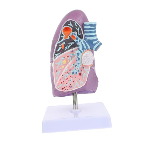 ULTECHNOVO Modell einer erkrankten Lunge Modelle Modell der Lungenanatomie medizinisches respiratorisches Lungenmodell anatomisches Modell Atemlungenmodell anzeigen Sektion Lehrmittel Plastik von ULTECHNOVO
