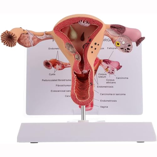 Weibliche Fortpflanzungsorgane Anatomie Modell Uterus Modell, Pathologischer Uterus und Eierstock Anatomisches Modell - Medizinische Anatomie der Frau Weibliche Fortpflanzungsorgane Anatomie Modell Uterus Modell, Pathologischer Uterus und Eierstock Anatomisches Modell - Medizinische Anatomie der Frau von UNbit