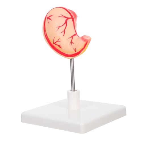 VALICLUD Anatomisches Modell Des Menschlichen : Magenmodell Für Die Ausbildung – -lehrmittel Für Den Naturwissenschaftlichen Unterricht Und Klinische Schulungen VALICLUD Anatomisches Modell Des Menschlichen : Magenmodell Für Die Ausbildung – -lehrmittel Für Den Naturwissenschaftlichen Unterricht Und Klinische Schulungen von VALICLUD