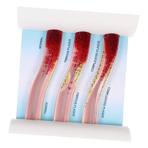 VALICLUD Anatomisches Modell Des Menschlichen Körpers Vaskuläres Modell Mit Detaillierten Blutgefäßen Für Medizinische Ausbildung Studium Hochwertiges Transparentes Design VALICLUD Anatomisches Modell Des Menschlichen Körpers Vaskuläres Modell Mit Detaillierten Blutgefäßen Für Medizinische Ausbildung Studium Hochwertiges Transparentes Design von VALICLUD