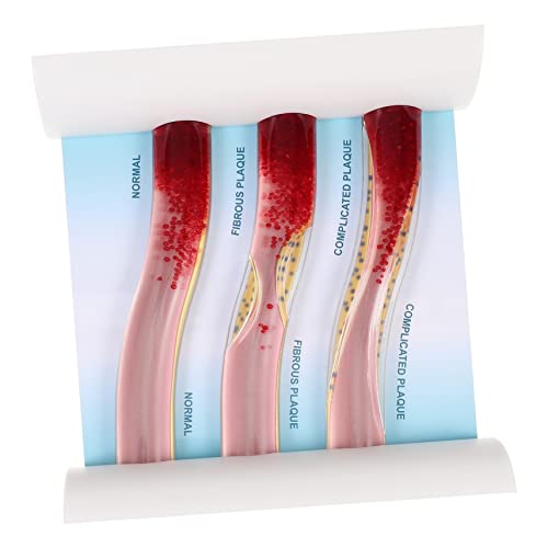 VALICLUD Dynamisches Anatomisches Modell Des Menschlichen Körpers Mit Blutgefäßmodell Lehrmaterial Für Medizinische Ausbildung Anatomische Studien VALICLUD Dynamisches Anatomisches Modell Des Menschlichen Körpers Mit Blutgefäßmodell Lehrmaterial Für Medizinische Ausbildung Anatomische Studien von VALICLUD