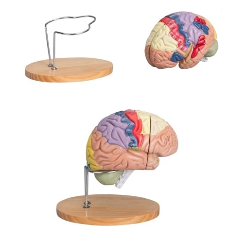 2-fache Vergrößerung 4-teilig, Am Gehirn Befestigtes Hirnarterienmodell Zerebrovaskuläres Modell Neurologie Anatomiemodell Des Menschlichen Gehirns Bildungsmodell Lebensgroßes Gehirnmodell von VERIMP