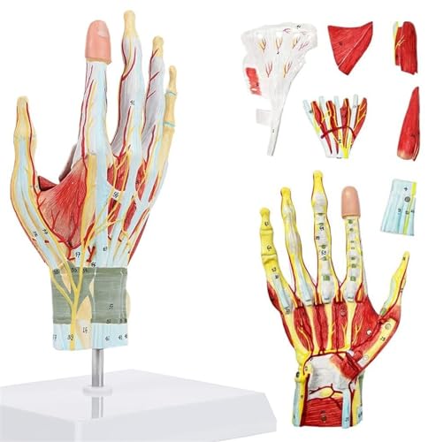 Abnehmbare Handmuskeln Mit Hauptblutgefäß- Und Nervenmodell. Lehrmittel For Handknochen Und Muskeln. Anatomisches Modell Des Menschlichen Skeletts. Medizinische Handfläche. Lokales von VERIMP