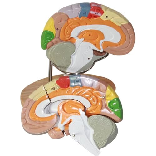 An Das Gehirn Angeschlossenes Gehirnarterienmodell Zerebrales Blutgefäßmodell Pädagogisches Modell Schädel Mit Gehirn Und Halswirbeln Anatomisch Abnehmbare Schädelkappe Anatomischer von VERIMP