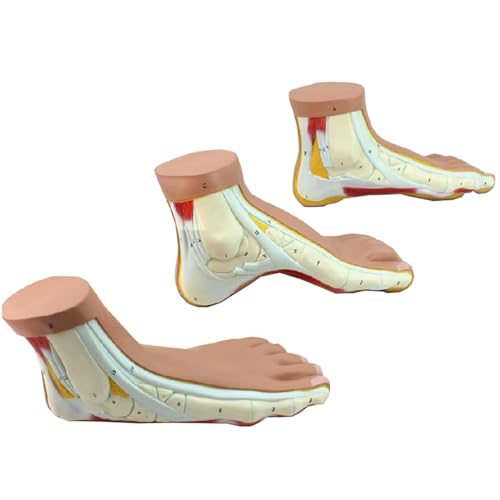 Anatomisches Modell For Normalen/gewölbten/flachen Fuß – Normaler Fuß Flacher Fuß, Cavus-Fuß Hoher Cavus-Fuß Modell Des Fußgelenks Skelettmodell Lebensgroßes Menschliches Fußmodell von VERIMP