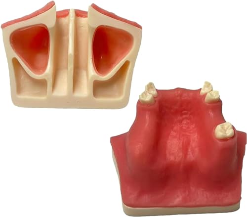 Implantat-Modell Oberkiefer-Sinus-Lift-Übung Weiches Zahnfleisch Oberkiefer-Sinus-Lift-Übungsmodell – Zahnimplantat-Übungsmodell – Orale Simulation Implantat Weiches Zahnfleisch-Zahnmaterial von VERIMP