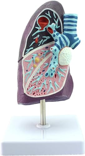 Medizinisches Menschliches Pathologisches Lungenmodell Modell Der Inneren Medizin Lungenmodell Lungenanatomie Atmungssystemmodell Anatomisches Modell Der Menschlichen Lunge – Pathologische von VERIMP