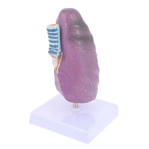 Menschliches Lungenpathologiemodell Lungenkrankheitsmodell Lungenmodell Raucherlunge Erkranktes Lungenmodell Kunststoffabschnitt Lehrmittel von VERIMP